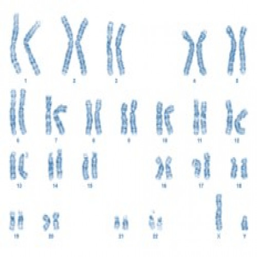 Karyotyping (Chromosome Analysis)